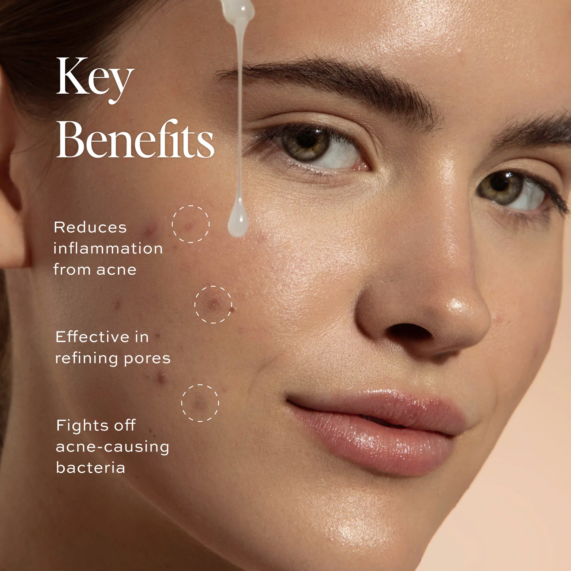 Acne Toning Serum - Image 3