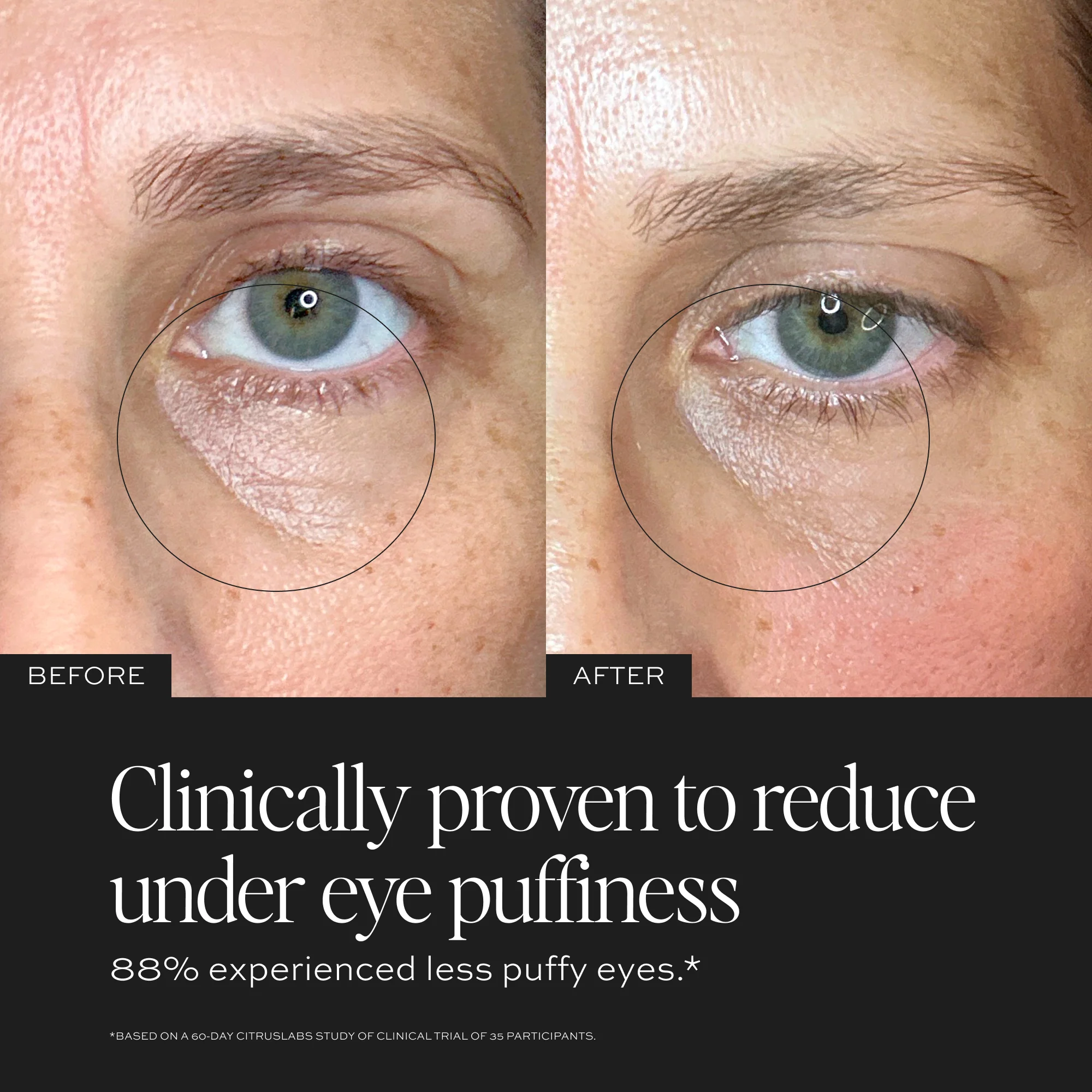 Luminosity™ Eye Serum - Image 5