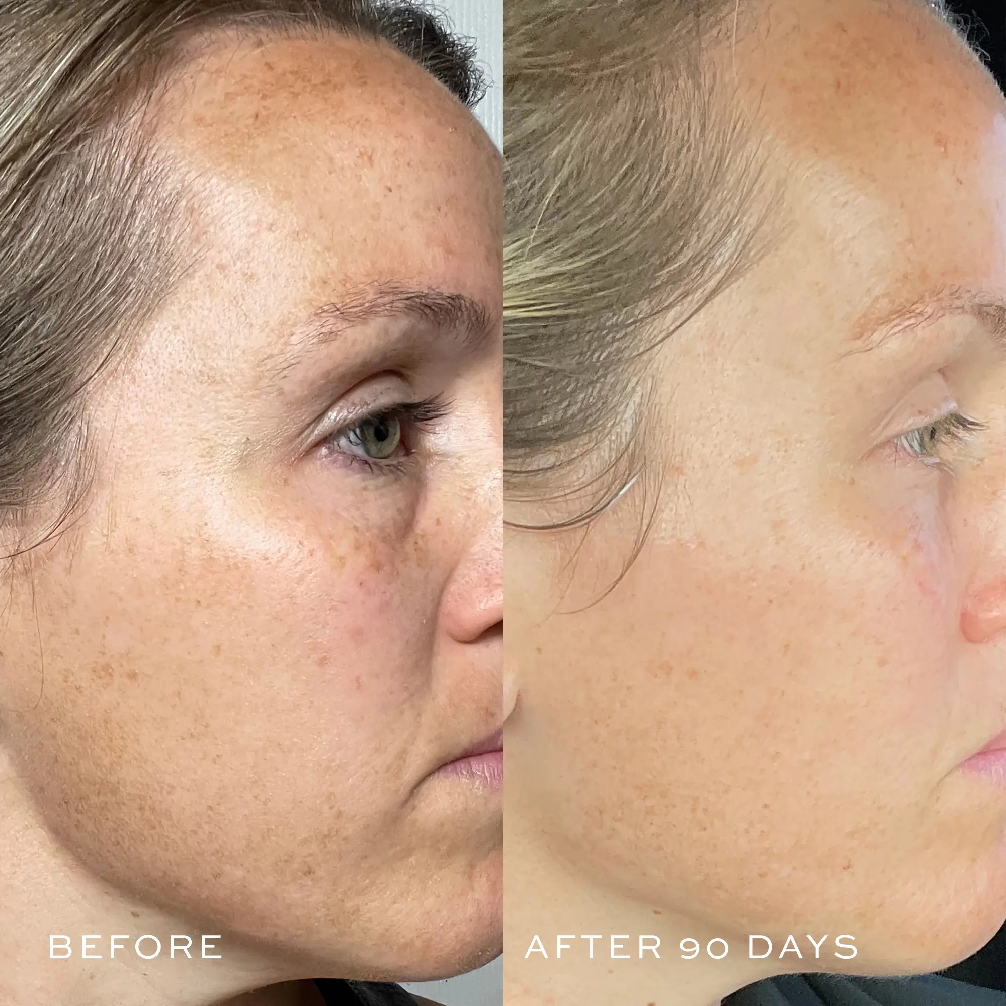 TBT® Serum (Anti-Aging Serum) - Image 5